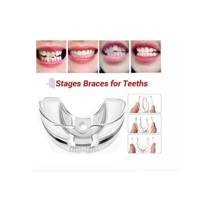 Formateur D'alignement Des Dents
Orthodontiques appareil Pour Aligner Les Dents